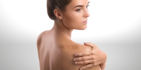 Yara İzi Tedavisi (Yara İzi / Skar Küçültme) 